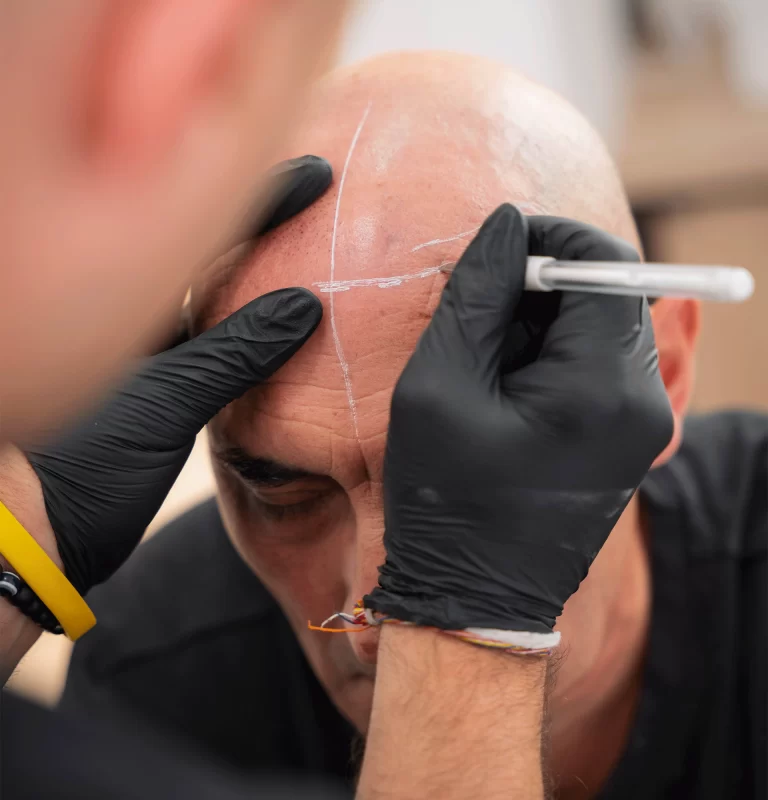 contenidos-curso-micropigmentacion-capilar