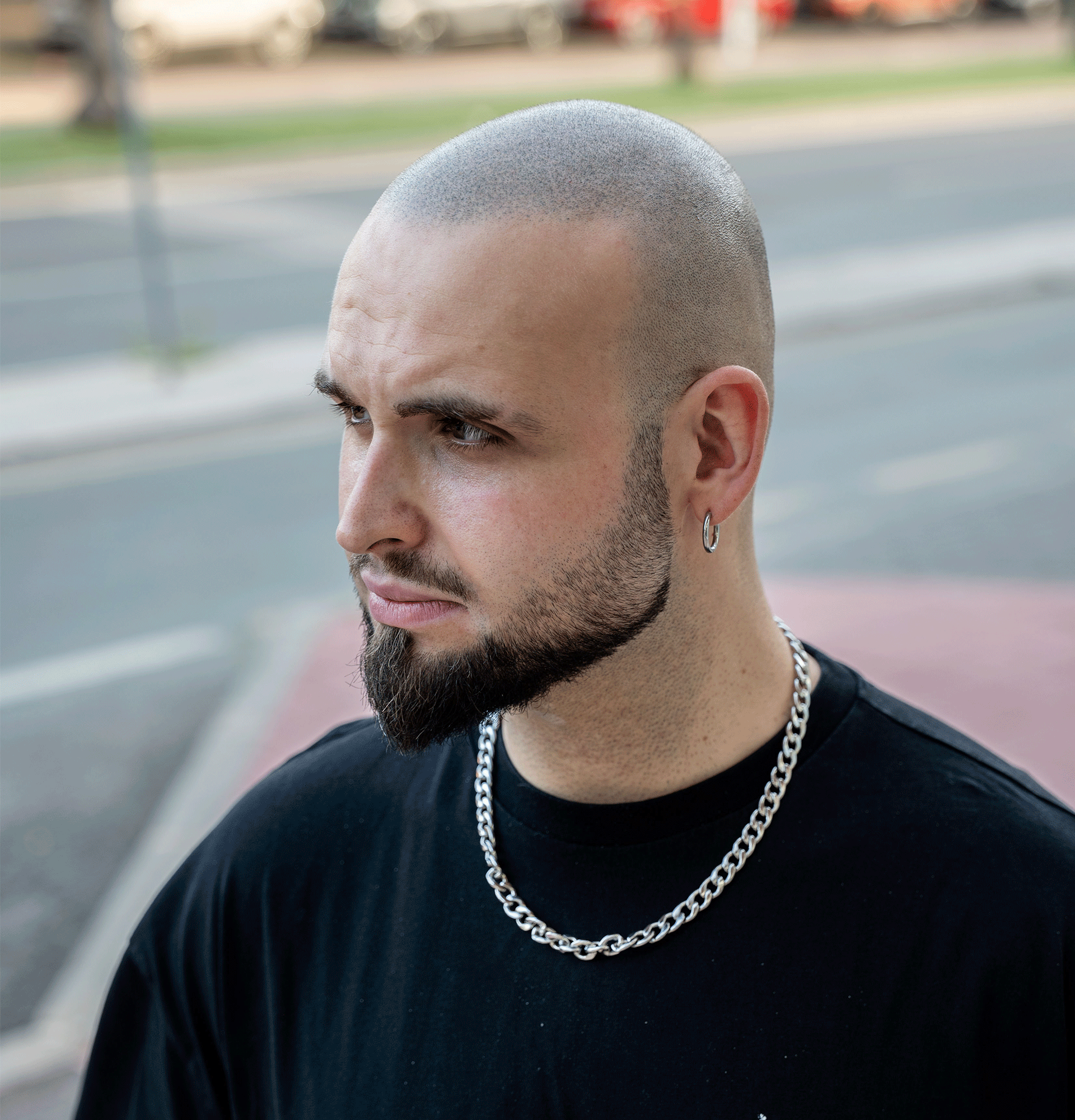 micropigmentacion-capilar-en-jovenes