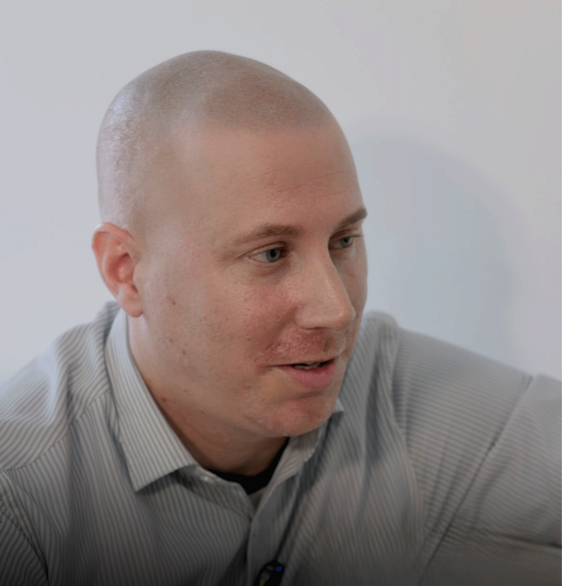 micropigmentacion-capilar-en-pelirrojos