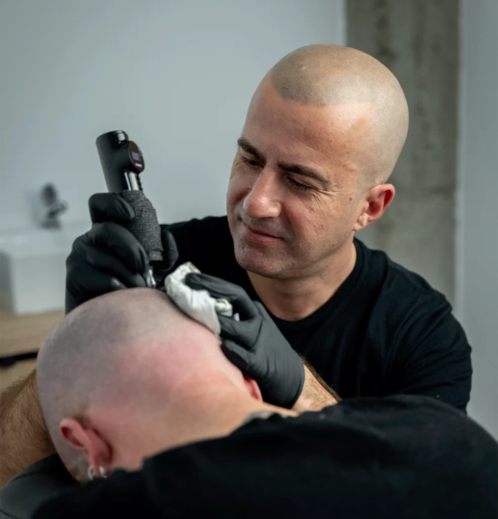 micropigmentacion-capilar-cuero-cabelludo-cuidados-tendencias