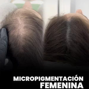 micropigmentacion-en-mujeres-caida-cabello